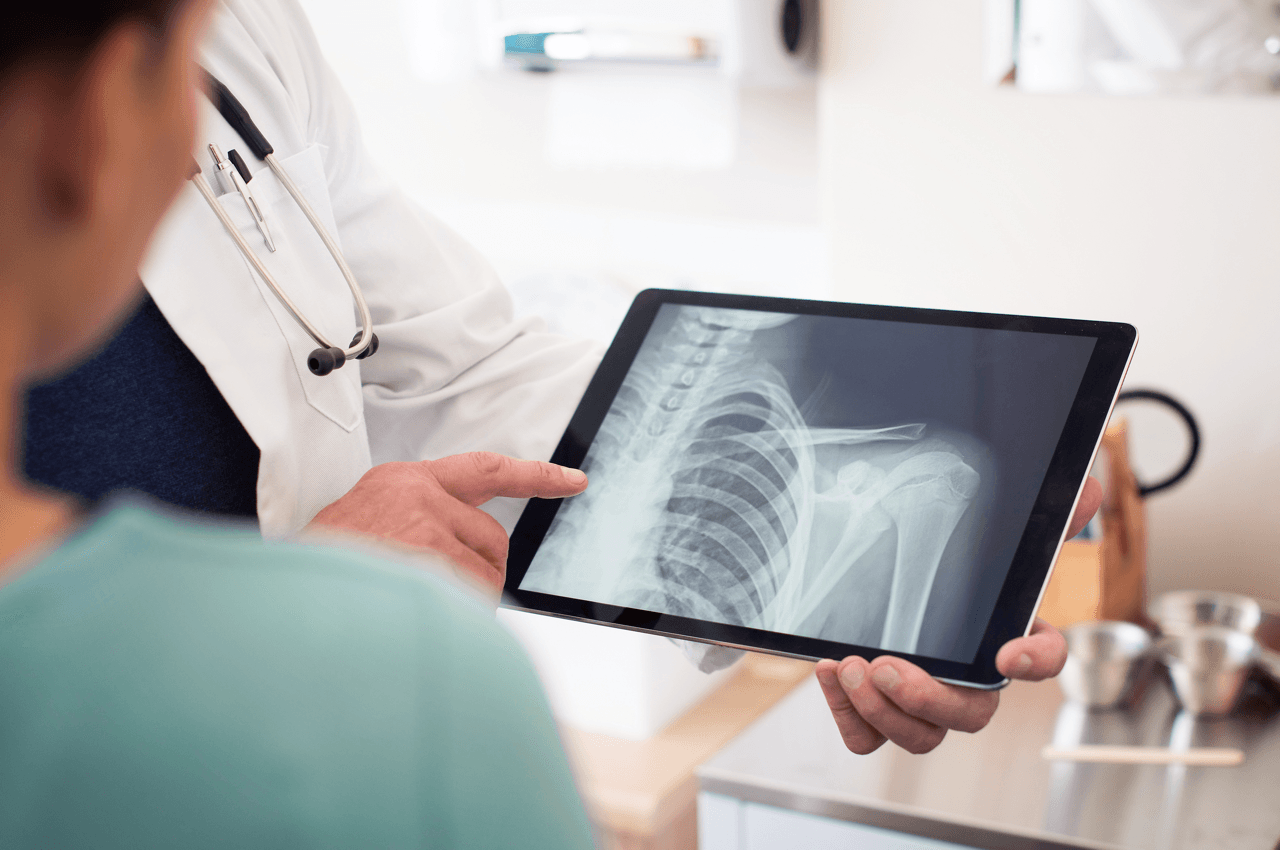 Médecin expliquant une radiographie affichée sur une tablette à un patient, illustrant le processus numérique de récupération et de consultation sécurisée des images médicales via Agora Care.